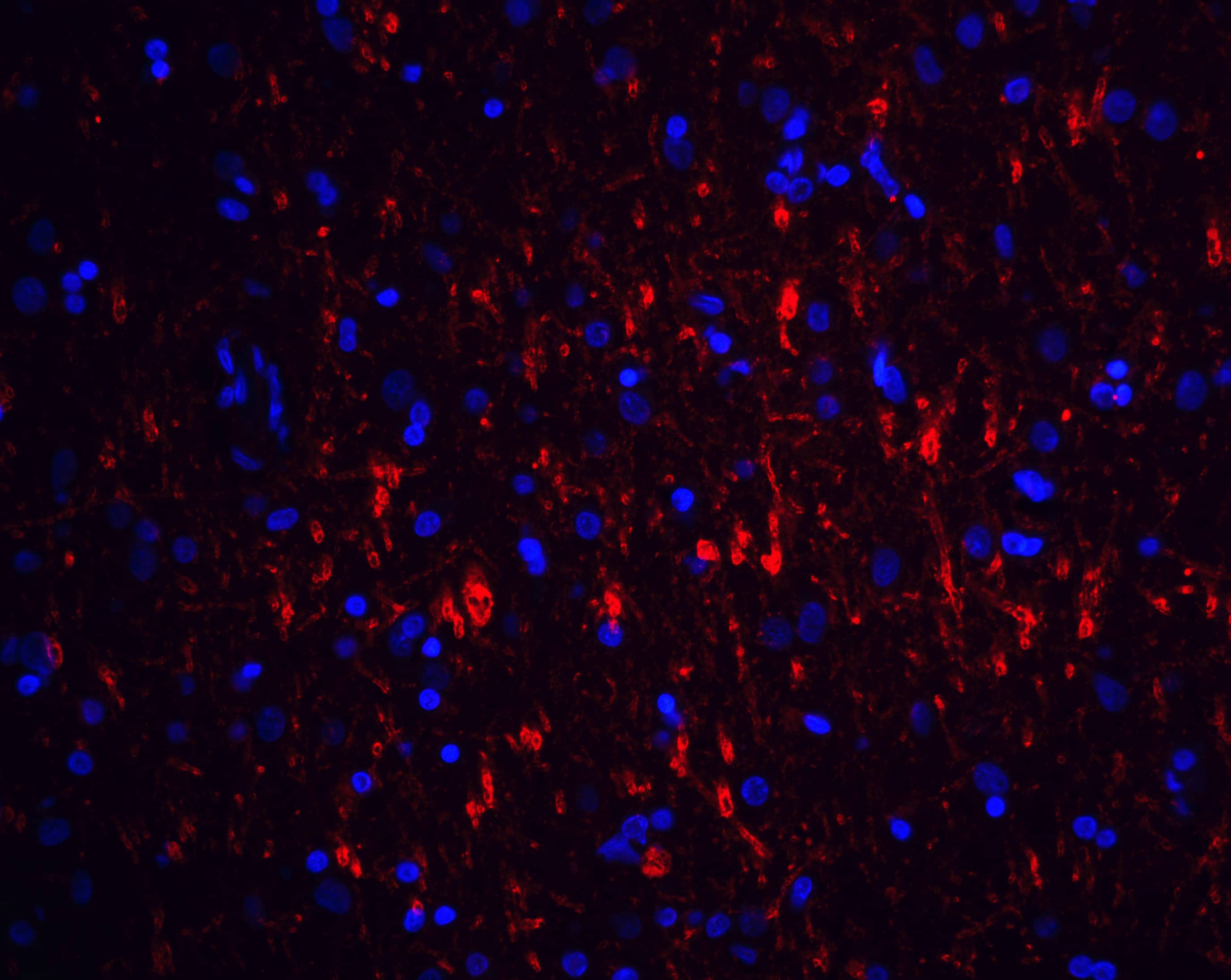 Immunocytochemistry/ Immunofluorescence: GFR alpha-1/GDNF R alpha-1 Antibody - BSA Free [NBP1-77043] - Immunofluorescence of GFR alpha 1 in human brain tissue with GFR alpha 1 antibody at 20 u/mL.Red: GFR alpha 1 Antibody   Blue: DAPI staining