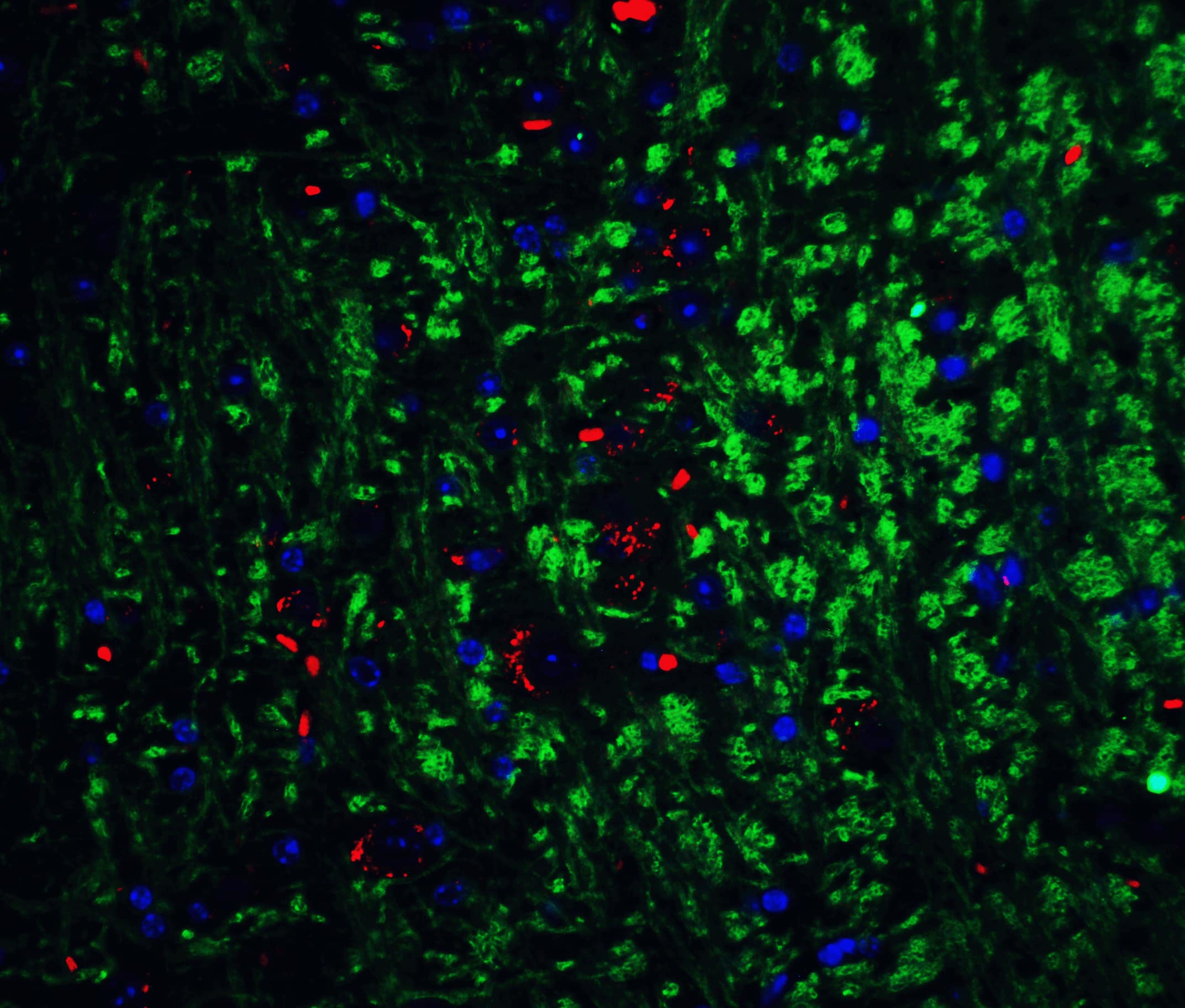 Immunocytochemistry/ Immunofluorescence: Neurturin Antibody - BSA Free [NBP1-77047] - Immunofluorescence of Neurturin in mouse brain tissue with Neurturin Antibody at 20 ug/mL.Green: Neuriturin Antibody   Red: Phylloidin staining Blue: DAPI staining