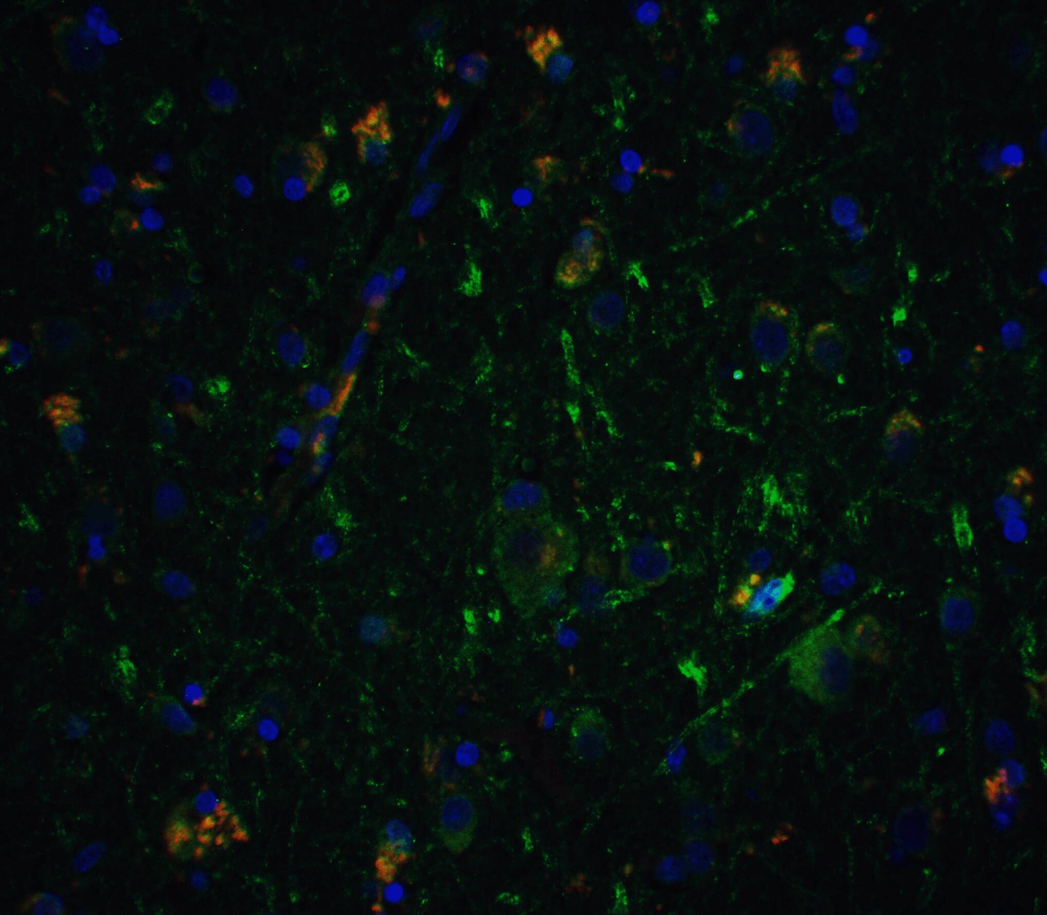 Immunocytochemistry/ Immunofluorescence: Neurturin Antibody - BSA Free [NBP1-77047] - Immunofluorescence of Neurturin in human brain tissue with Neurturin antibody at 5 ug/ml.Green: Neuriturin Antibody   Red: Phylloidin staining Blue: DAPI staining