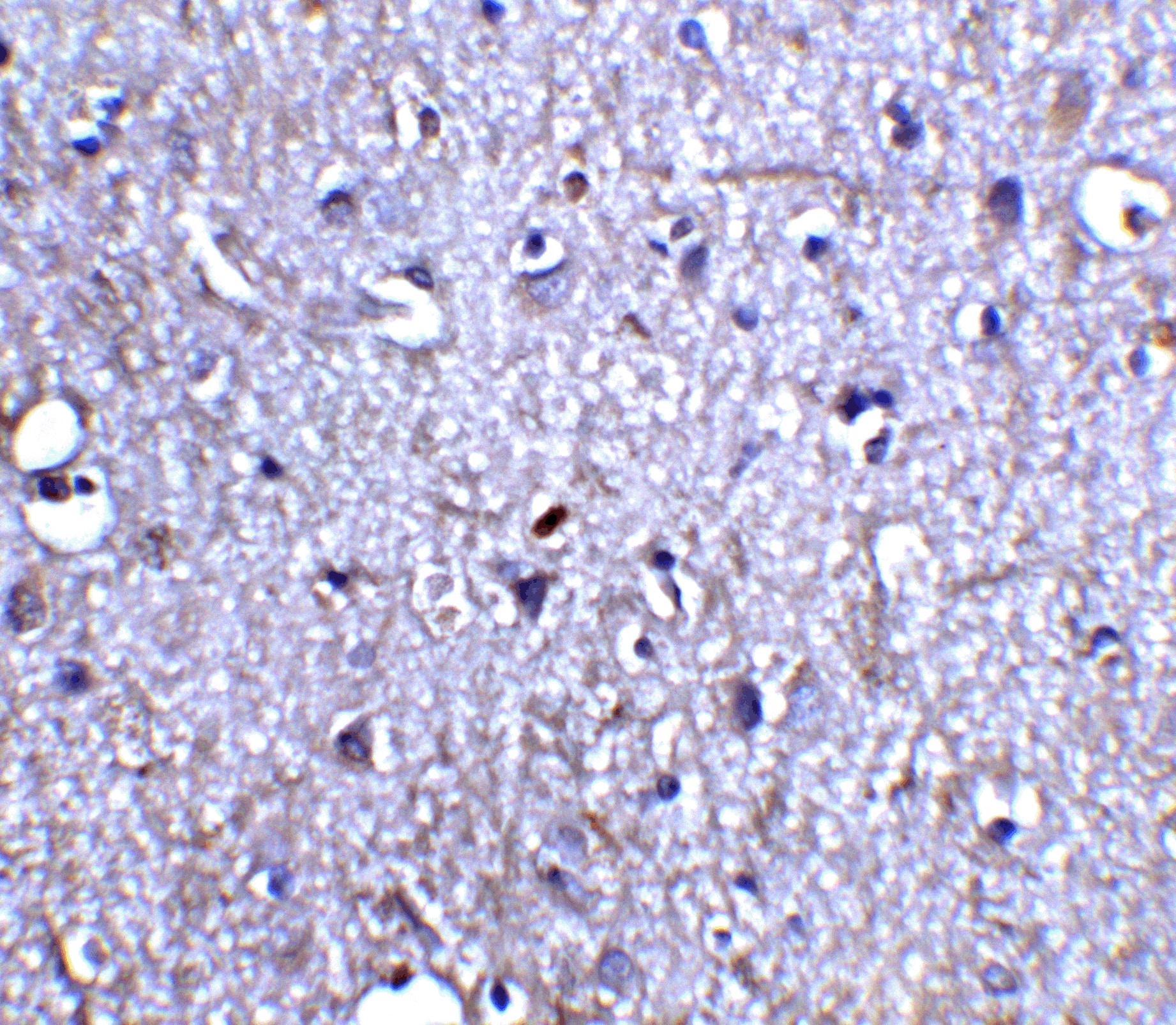 Immunohistochemistry: Neurturin Antibody - BSA Free [NBP1-77047] - Immunohistochemistry of Neurturin in human brain tissue with Neurturin antibody at 5 ug/ml.