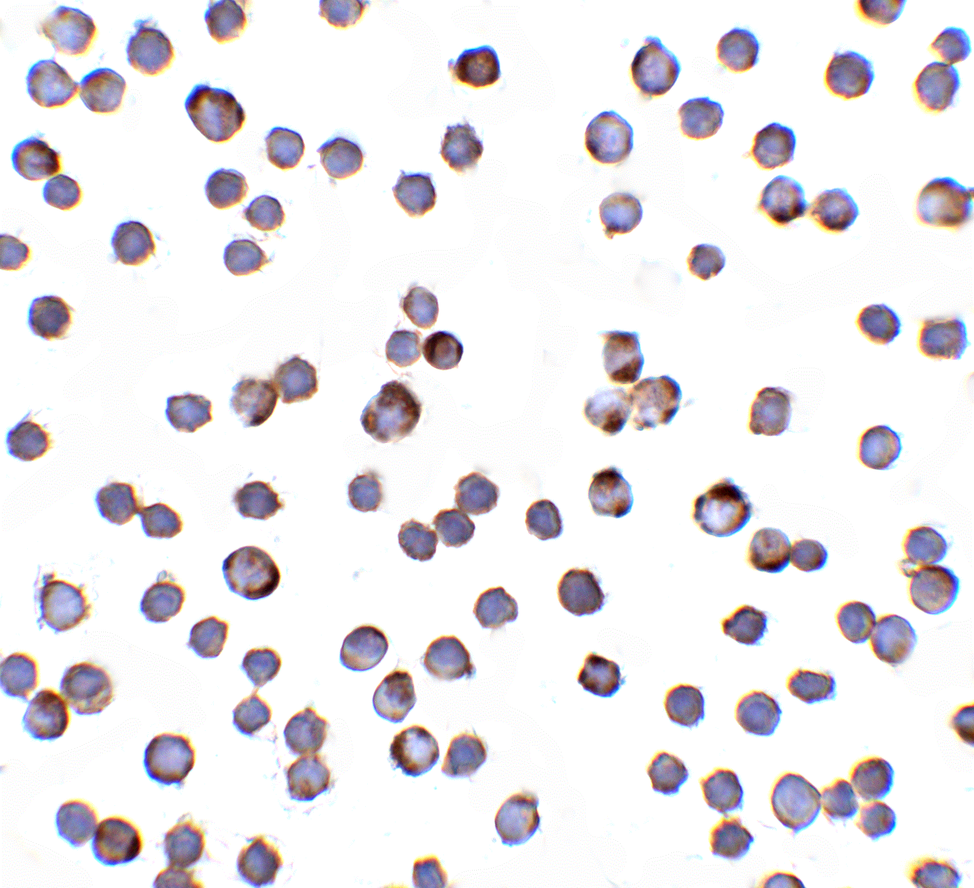 Immunocytochemistry/ Immunofluorescence: RAIDD/CRADD Antibody - BSA Free [NBP1-77048] - Immunocytochemistry of RAIDD/CRADD in Hela cells with RAIDD/CRADD antibody at 10 ug/mL.