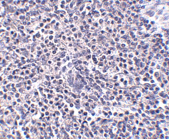 Immunohistochemistry ARL15 Antibody - BSA Free