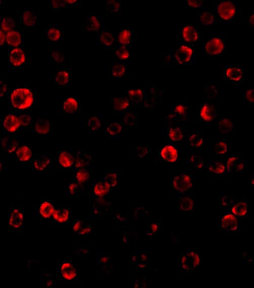 Immunocytochemistry/ Immunofluorescence: RAIDD/CRADD Antibody - BSA Free [NBP1-77061] - Immunofluorescence of RAIDD/CRADD in Hela cells with RAIDD/CRADD antibody at 20 ug/mL.