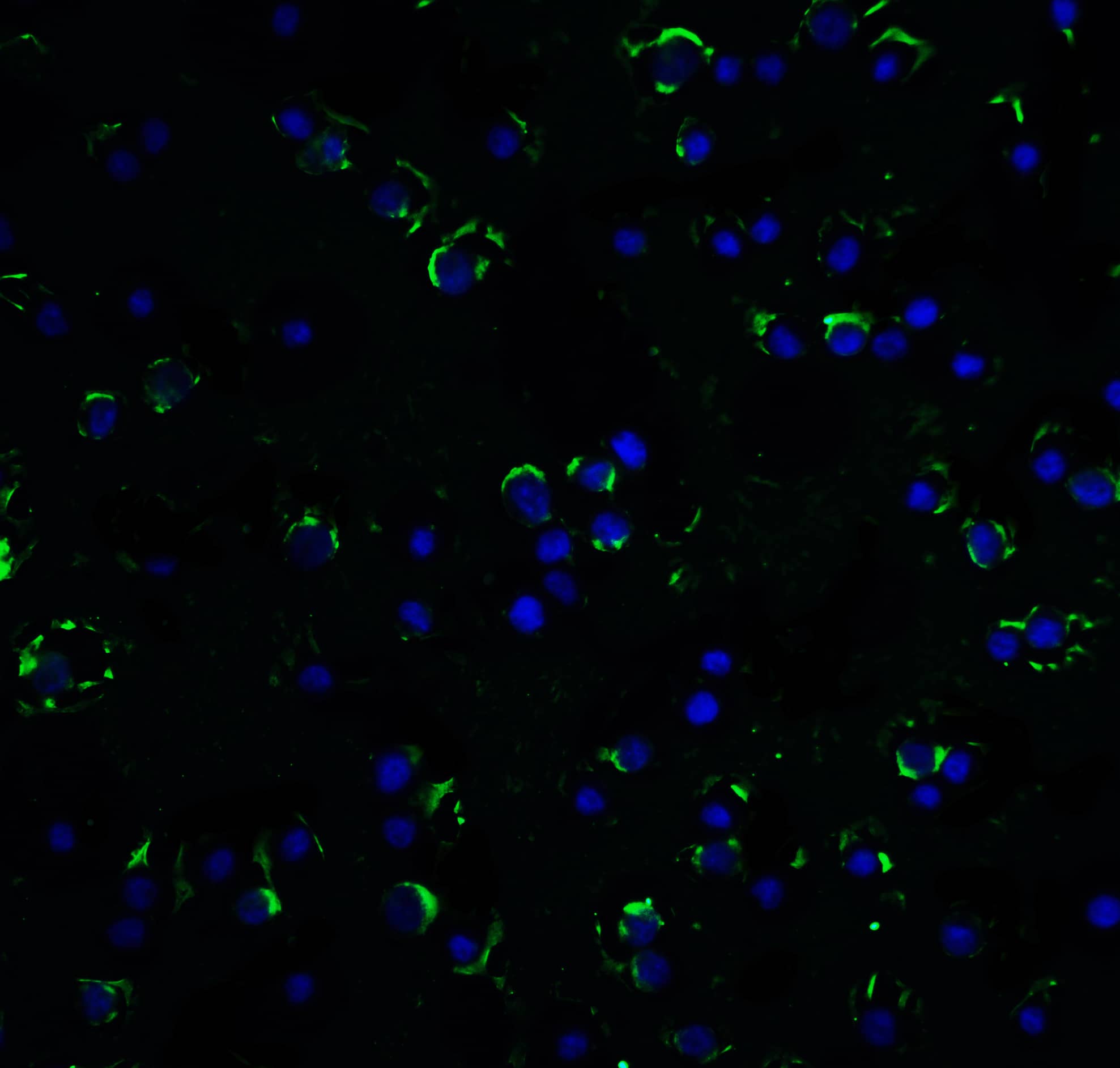 Immunocytochemistry/ Immunofluorescence: RAIDD/CRADD Antibody - BSA Free [NBP1-77061] - Immunofluorescence of RAIDD/CRADD in Hela cells with RAIDD/CRADD antibody at 20 ug/mL.