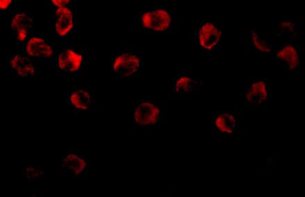 Immunocytochemistry/ Immunofluorescence: DOK1 Antibody - BSA Free [NBP1-77064] - Immunofluorescence of DOK1 in K562 cells with DOK1 antibody at 10 u/ml.