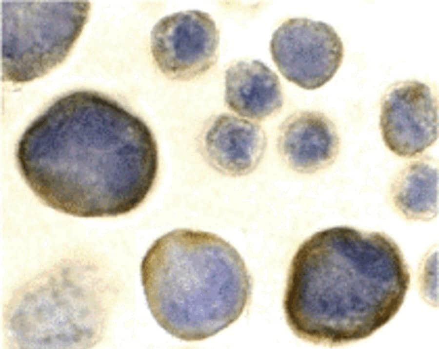 Immunocytochemistry/ Immunofluorescence: CXCR4 Antibody - BSA Free [NBP1-77067] - Figure 9 Immunocytochemistry Validation of CXCR4 in HeLa Cells  Immunocytochemical analysis of HeLa cells using anti-CXCR4 antibody  at 2 u/ml. Cells was fixed with formaldehyde and blocked with 10% serum for 1 h at RT; antigen retrieval was by heat mediation with a citrate buffer (pH6). Samples were incubated with primary antibody overnight at 4;C. A goat anti-rabbit IgG H&L (HRP) at 1/250 was used as secondary. Counter stained with Hematoxylin.