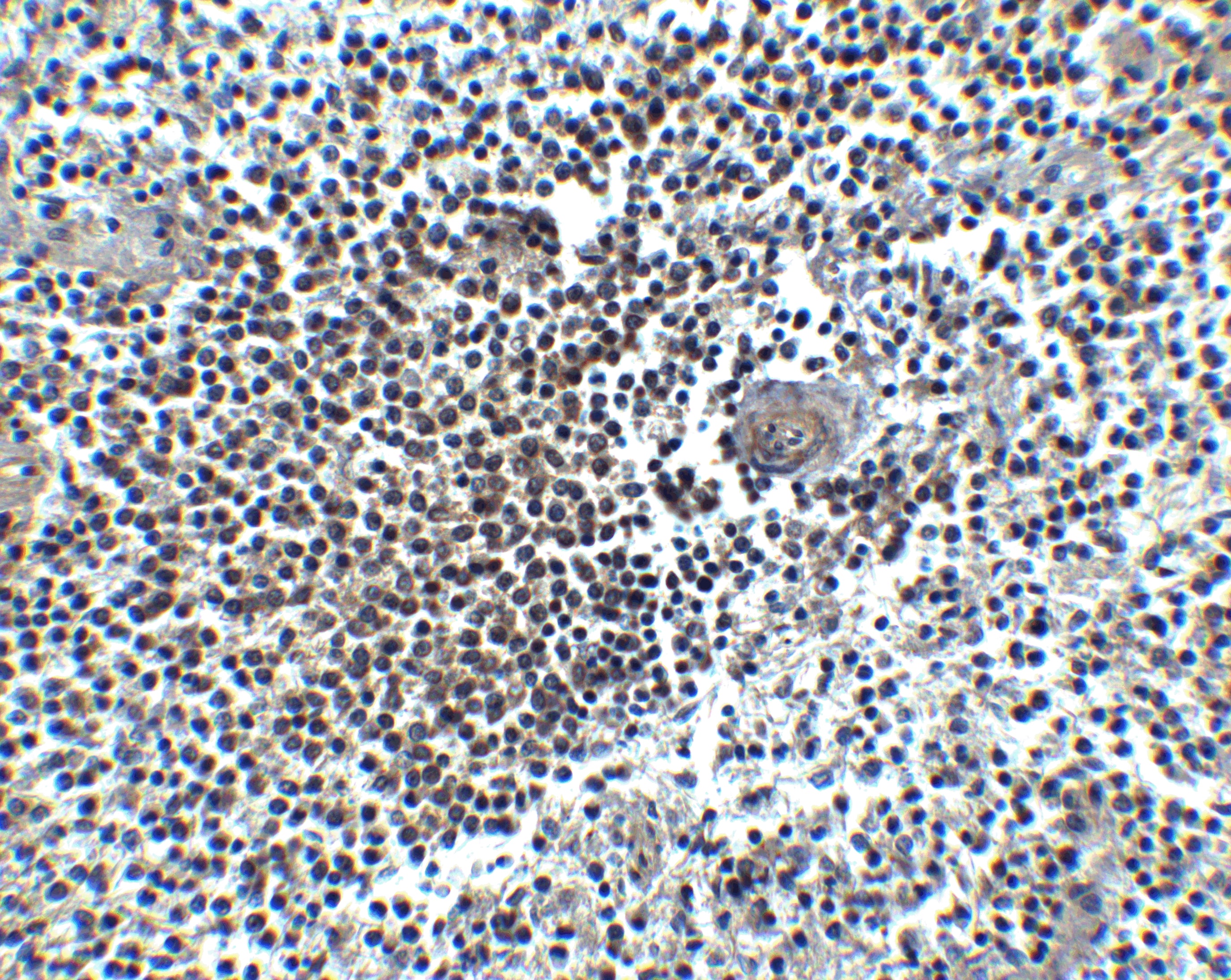 Immunohistochemistry: CXCR4 Antibody - BSA Free [NBP1-77067] - Figure 8 Immunohistochemistry Validation of CXCR4 in Human Spleen Immunohistochemical analysis of paraffin-embedded human spleen tissue using anti-CXCR4 antibody  at 5 u/ml. Tissue was fixed with formaldehyde and blocked with 10% serum for 1 h at RT; antigen retrieval was by heat mediation with a citrate buffer (pH6). Samples were incubated with primary antibody overnight at 4C. A Goat anti-rabbit IgG H&L (HRP) at 1/250 was used as secondary. Counter stained with Hematoxylin.