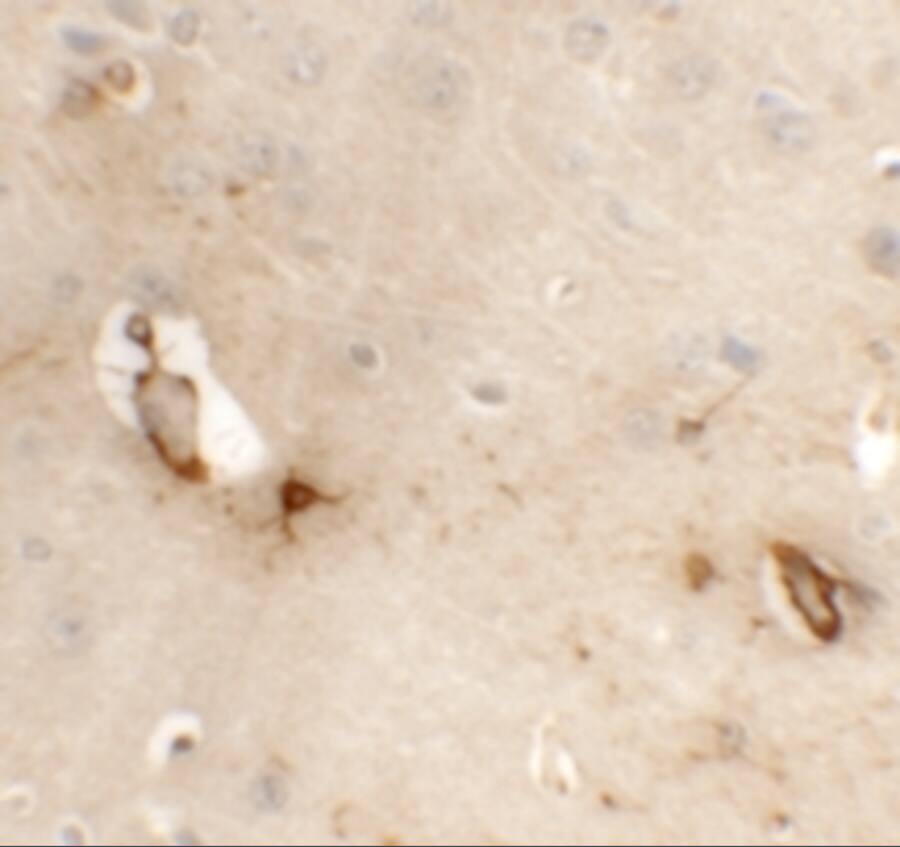 Immunohistochemistry: CLP24/TMEM204 Antibody - BSA Free [NBP1-77069] - Immunohistochemistry of CLP24/TMEM204 in mouse brain tissue with CLP24/TMEM204 antibody at 5 u/mL.