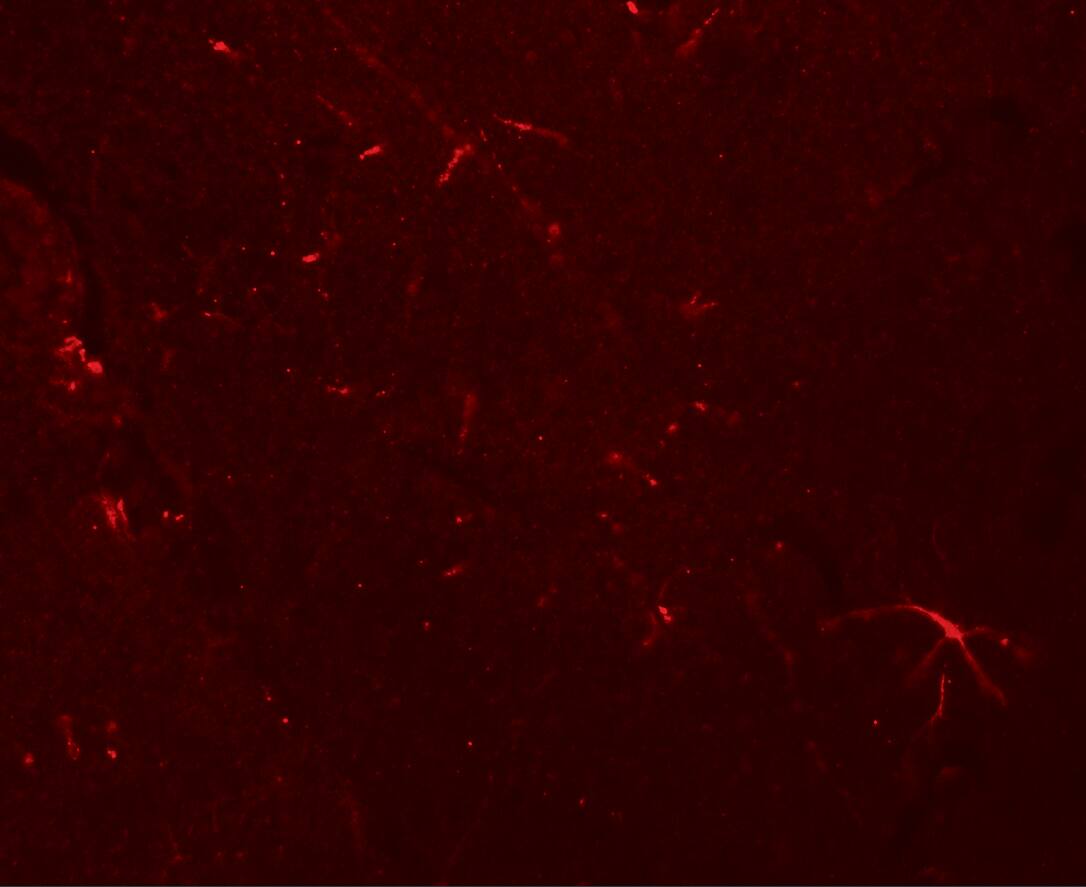 Immunocytochemistry/ Immunofluorescence: CLP24/TMEM204 Antibody - BSA Free [NBP1-77069] - Immunofluorescence of CLP24/TMEM204 in mouse brain tissue with CLP24/TMEM204 antibody at 20 u/mL.