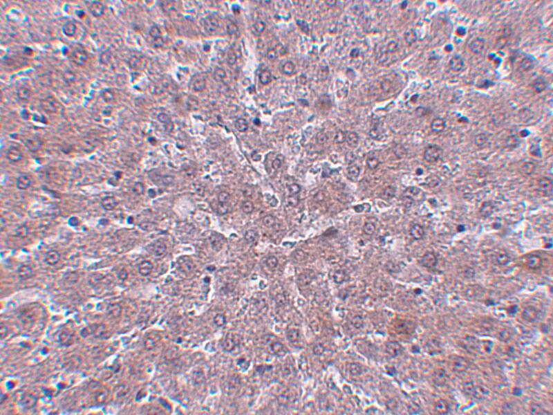 Immunohistochemistry JMJD1B Antibody - BSA Free