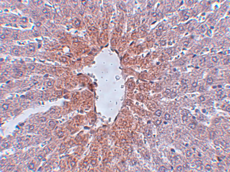 Immunohistochemistry JMJD1C Antibody - BSA Free