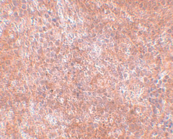 Immunohistochemistry: JMJD8 Antibody - BSA Free [NBP1-77076] - Immunohistochemistry of JMJD8 in mouse spleen tissue with JMJD8 antibody at 2.5 ug/mL.