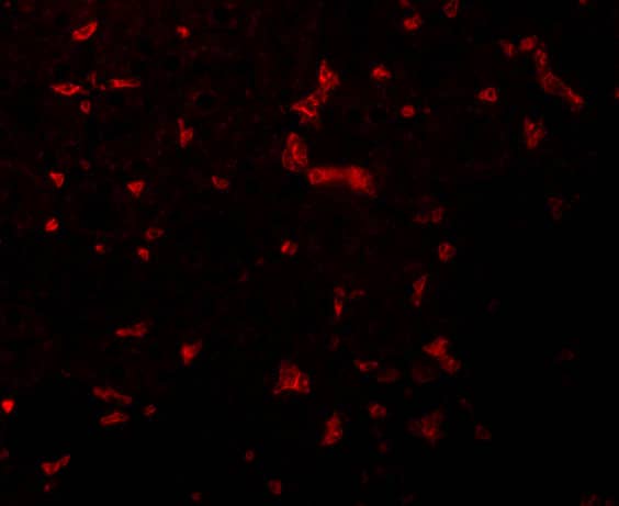 Immunocytochemistry/ Immunofluorescence: RIPK1/RIP1 Antibody - BSA Free [NBP1-77077] - Immunofluorescence of RIPK1/RIP1 in Mouse Kidney cells with RIPK1/RIP1 antibody at 20 ug/mL.