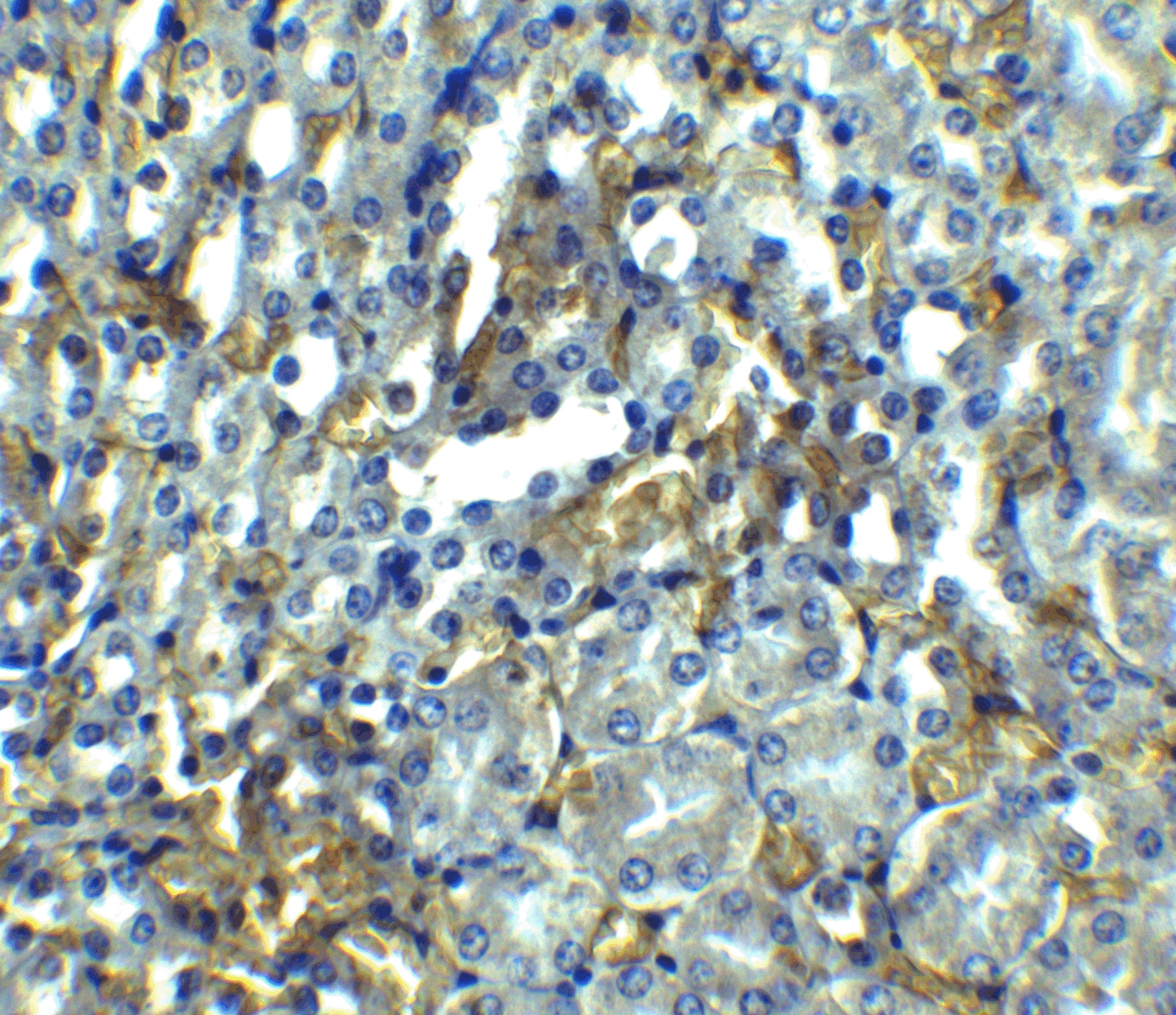 Immunohistochemistry: RIPK1/RIP1 Antibody - BSA Free [NBP1-77077] - Immunohistochemistry of RIPK1/RIP1 in mouse kidney tissue with RIPK1/RIP1 antibody at 2.5 ug/ml.