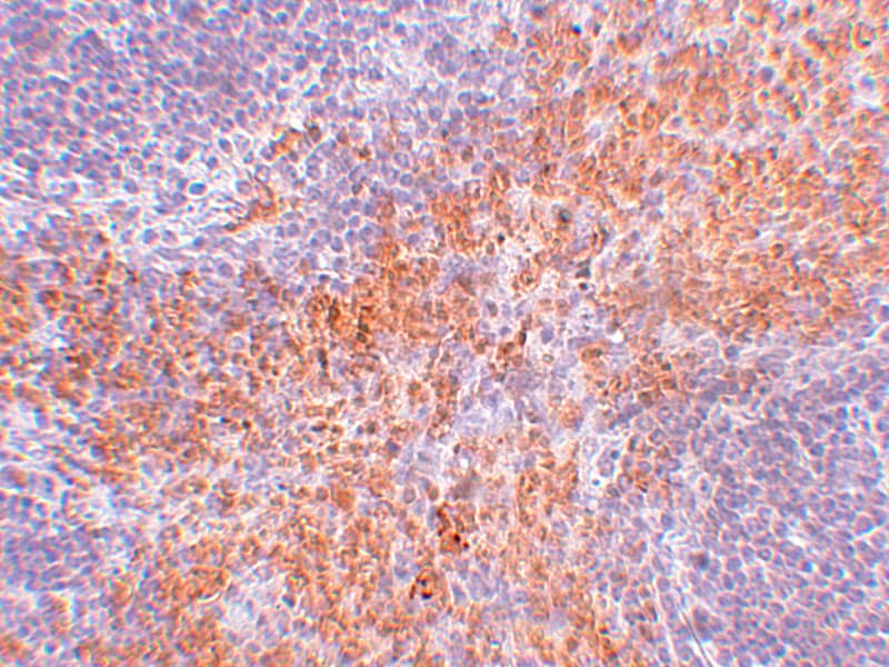 Immunohistochemistry: RIPK1/RIP1 Antibody - BSA Free [NBP1-77077] - Immunohistochemistry of RIPK1/RIP1 in mouse kidney tissue with RIPK1/RIP1 antibody at 2.5 ug/mL.