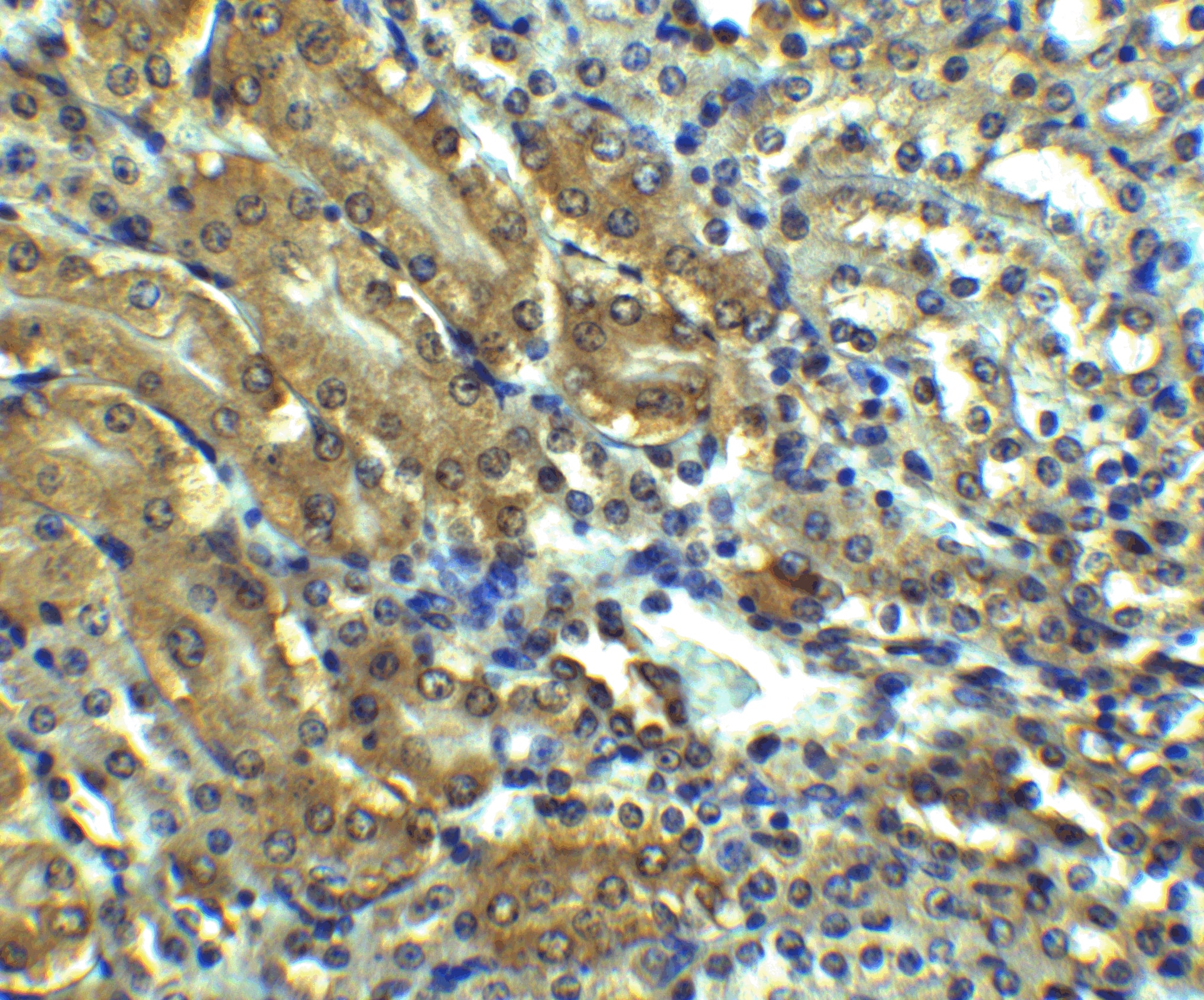 Immunohistochemistry: AGTR-1 Antibody - BSA Free [NBP1-77078] - Immunohistochemistry of AGTR-1 in mouse kidney tissue with AGTR-1 antibody at 2.5 u/ml.