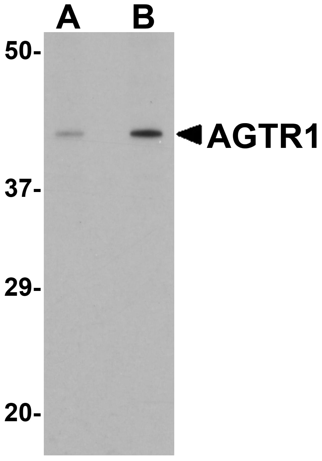 Western Blot: AGTR-1 Antibody - BSA Free [NBP1-77078] - Western blot analysis of AGTR-1 in mouse kidney tissue lysate with AGTR-1 antibody at (A) 1 and (B) 2 u/mL.