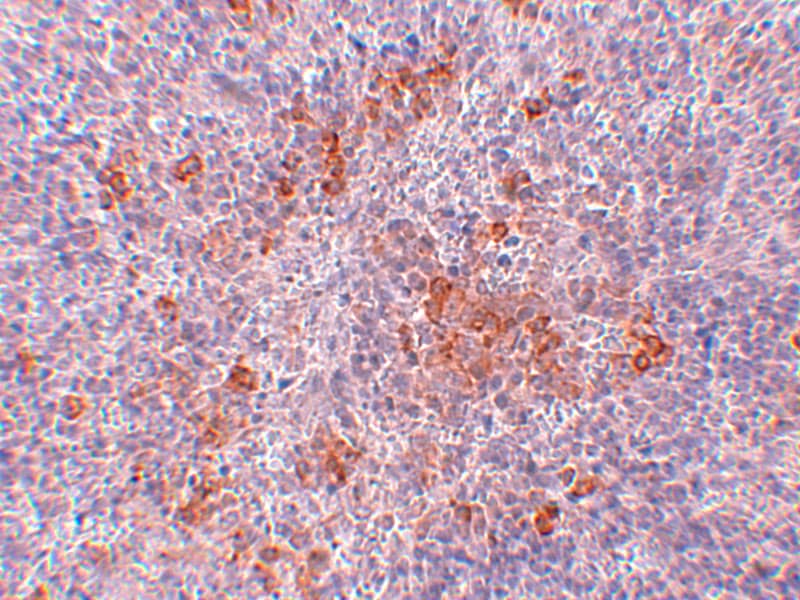 Immunohistochemistry: AGTR-1 Antibody - BSA Free [NBP1-77078] - Immunohistochemistry of AGTR-1 in mouse kidney tissue with AGTR-1 antibody at 2.5 u/mL.