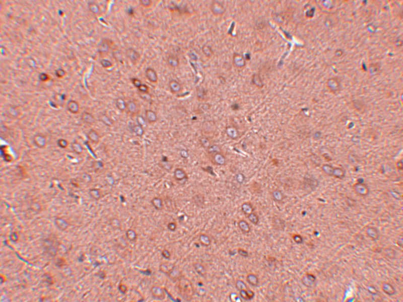 Immunohistochemistry: GOLM1 Antibody - BSA Free [NBP1-77079] - Immunohistochemistry of GOLM1 in rat brain tissue with GOLM1 antibody at 2.5 u/mL.