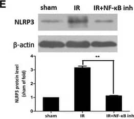 Western Blot: NLRP3/NALP3 Antibody - BSA Free [NBP1-77080] - HMGB1 regulated the activation of NLRP3, rather than the activation of caspase-8, via NF-kappa B pathway. a, b NF-kappa B was activated in ischemic retina at the early stage after reperfusion. c, d Intraocular injection rHMGB1 or GA could promote or suppress the production of phosphor-NF-kappa B p65. e, f Intravitreal injection of NF-kappa B p65 inhibitor, JSH-23, significantly reduced the activation of NLRP3 & decreased the processing of IL-1 beta , g rather than caspase-8. However, intravitreal injection of caspase-8 inhibitor, Z-IETD-fmk, decreased the production of phosphor-NF-kappa B p65, obviously (h). Data are shown as mean ± SD. *P < 0.05, **P < 0.01 vs sham group Image collected & cropped by CiteAb from the following publication (//pubmed.ncbi.nlm.nih.gov/26224068), licensed under a CC-BY license. Not internally tested by Novus Biologicals.