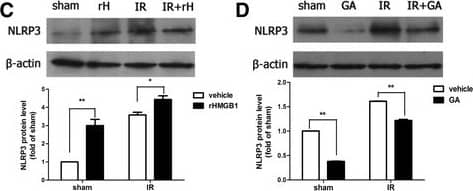 Western Blot: NLRP3/NALP3 Antibody - BSA Free [NBP1-77080] - HMGB1 promoted the activation of canonical NLRP3 inflammasome in retinal IR injury. The intravitreal injection of exogenous rHMGB1 significantly promoted the mRNA & protein production of NLRP3 (a, c) & ASC (e, g) & activation of caspase-1 (i). Thus, the intravitreal injection of HMGB1 inhibitor, GA, significantly suppressed the production of NLRP3 (b, d) & ASC (f, h) & activation of caspase-1 (j). Data are shown as mean ± SD. *P < 0.05, **P < 0.01 vs sham group Image collected & cropped by CiteAb from the following publication (//pubmed.ncbi.nlm.nih.gov/26224068), licensed under a CC-BY license. Not internally tested by Novus Biologicals.