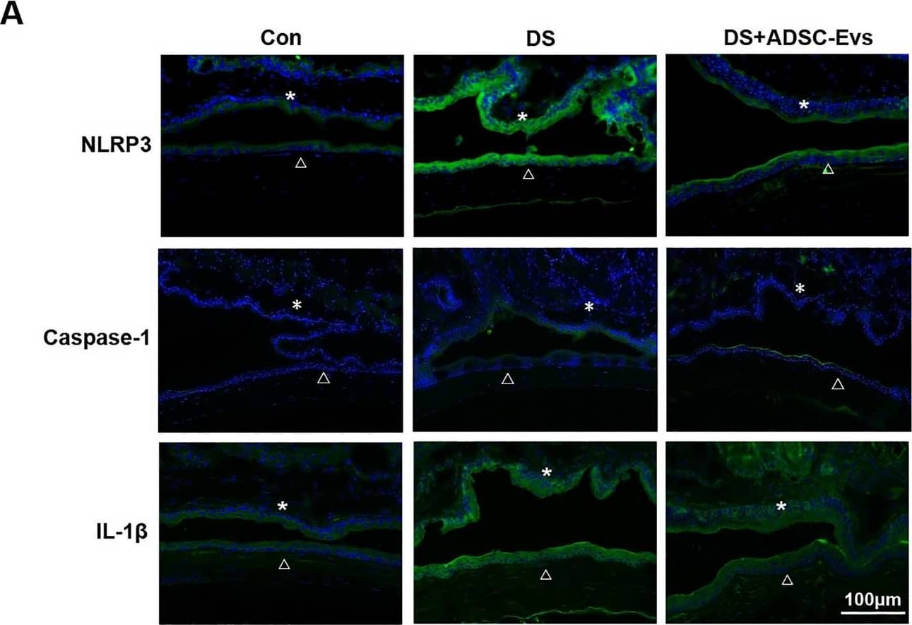 Immunocytochemistry/ Immunofluorescence: NLRP3/NALP3 Antibody - BSA Free [NBP1-77080] - hADSC-Evs suppressed NLRP3 inflammasome activation in ocular surface of experimental mice under desiccating stress. (A) Representative image of immunofluorescent staining of NLRP3 related genes in corneal & conjunctival epithelia of desiccating mice or treated with hADSC-EVs (*conjunctiva; open triangle cornea). (B,C) qRT-PCR showed the mRNA levels of NLRP3 related genes in conjunctiva & cornea (four corneas/conjunctivas were mixed as a sample). Data was shown as mean ± SEM. *p < 0.05. Image collected & cropped by CiteAb from the following publication (//pubmed.ncbi.nlm.nih.gov/32884023), licensed under a CC-BY license. Not internally tested by Novus Biologicals.