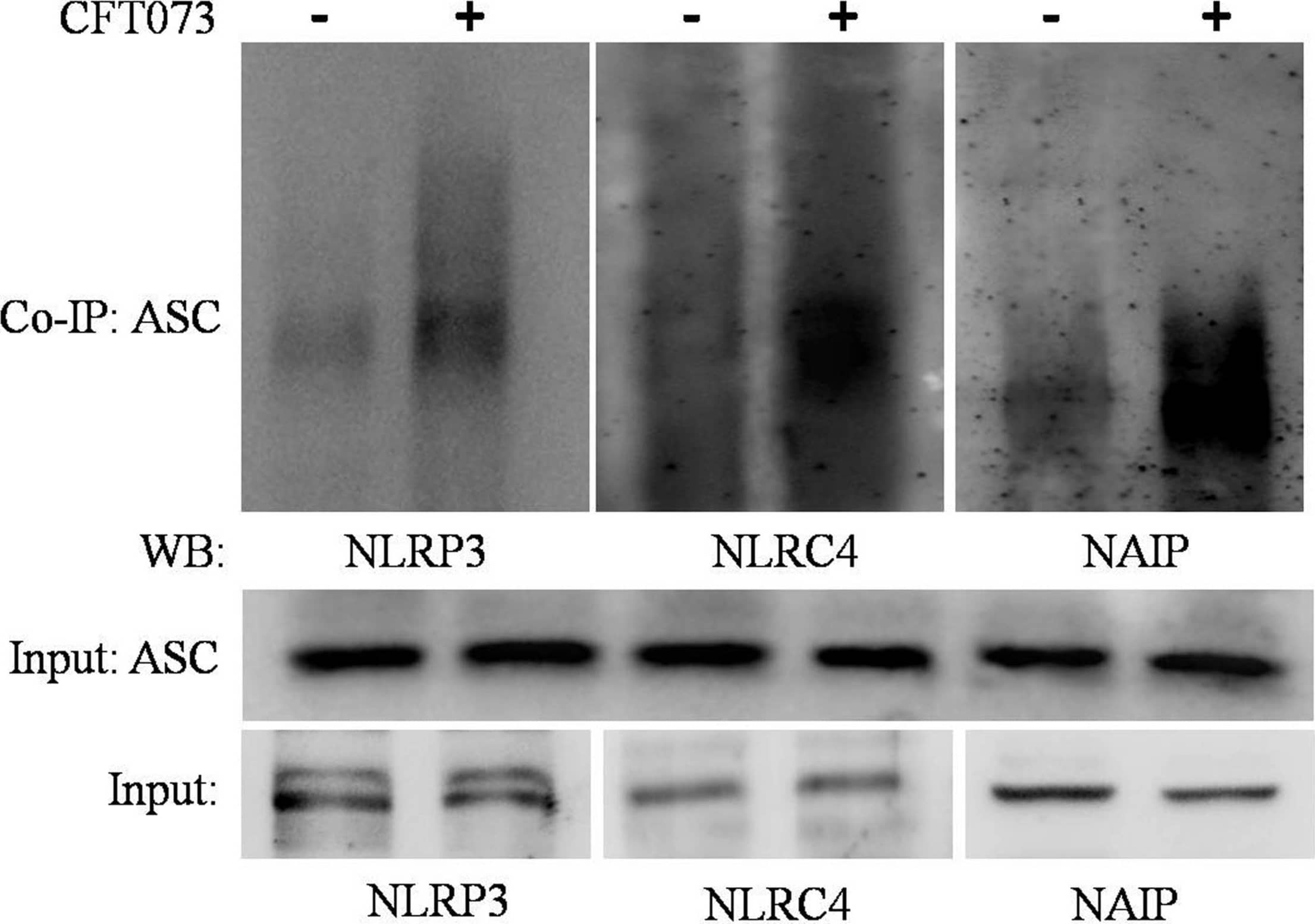 Western Blot: NLRP3/NALP3 Antibody - BSA Free [NBP1-77080] - Co-immunoprecipitation assay: Figure showing interaction of NLRP3, NLRC4 & NAIP with ASC during CFT073 infection in THP-1m. Cytoplasmic extracts of THP-1m infected with or without CFT073, 6 h post stimulation were subjected to IP & WB by various antibodies (ASC, NLRP3, NLRC4, & NAIP) as described in material & methods. Cytoplasmic extract used as input was subjected to check NLRP3, ASC, NLRC4 & NAIP expression as shown in figure. ASC antibody was used to co-immunoprecipitate the complex from cytoplasmic extracts & then immunoblotted to detect NLRP3, NLRC4 & NAIP. Image collected & cropped by CiteAb from the following publication (//pubmed.ncbi.nlm.nih.gov/31551961), licensed under a CC-BY license. Not internally tested by Novus Biologicals.