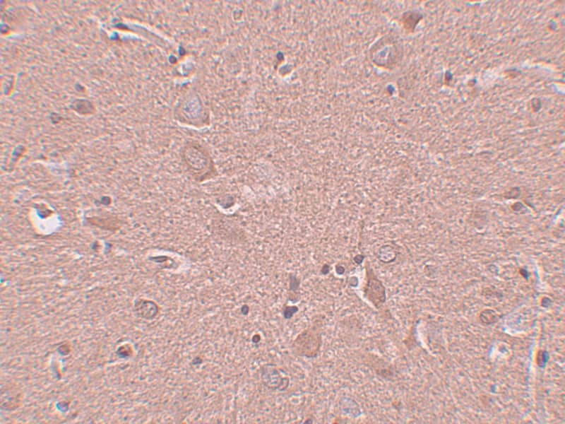 Immunohistochemistry SRPX Antibody - BSA Free