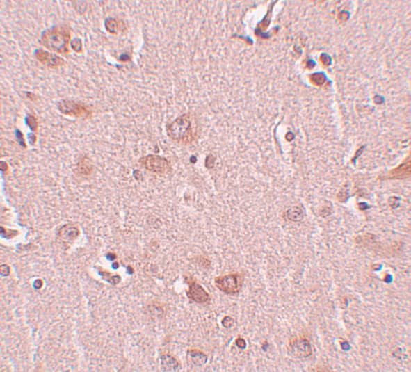 Immunohistochemistry PLEKHM2 Antibody - BSA Free