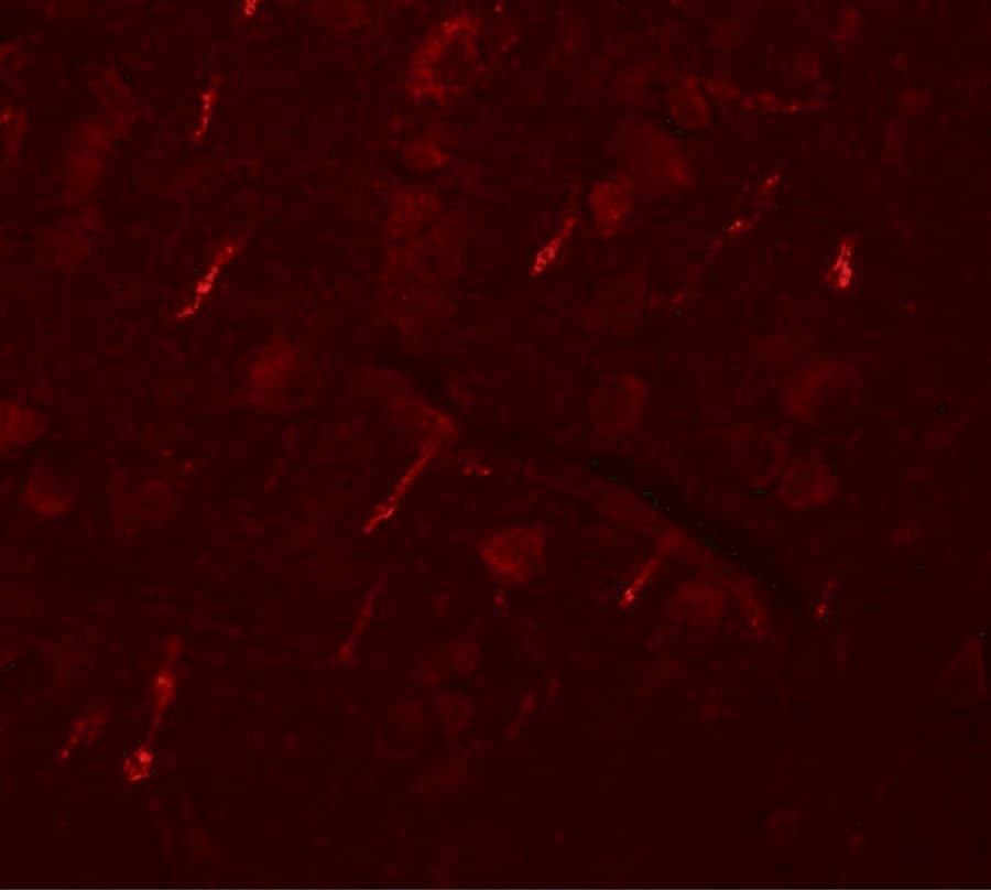 Immunocytochemistry/ Immunofluorescence: SIPA1L2 Antibody - BSA Free [NBP1-77090] - Immunofluorescence of SIPA1L2 in human brain tissue with SIPA1L2 antibody at 20 ug/mL.
