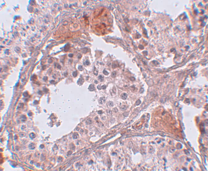 Immunohistochemistry: CABS1 Antibody - BSA Free [NBP1-77091] - Immunohistochemistry of CABS1 in human testis tissue with CABS1 antibody at 5 ug/mL.