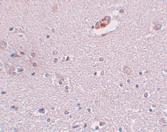 Immunohistochemistry ZNF536 Antibody - BSA Free