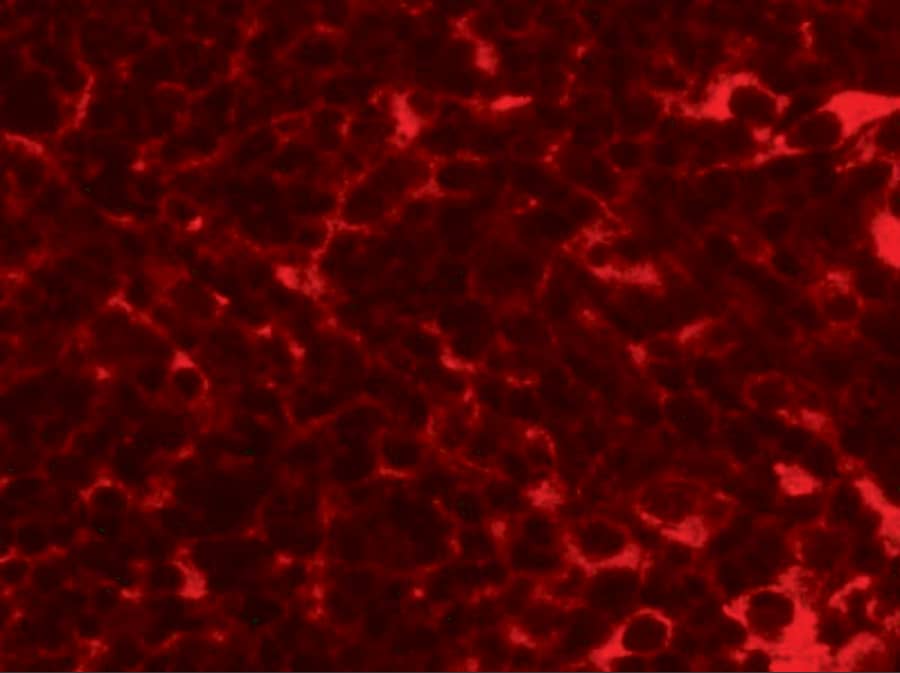 Immunocytochemistry/ Immunofluorescence TMEM38B Antibody - BSA Free