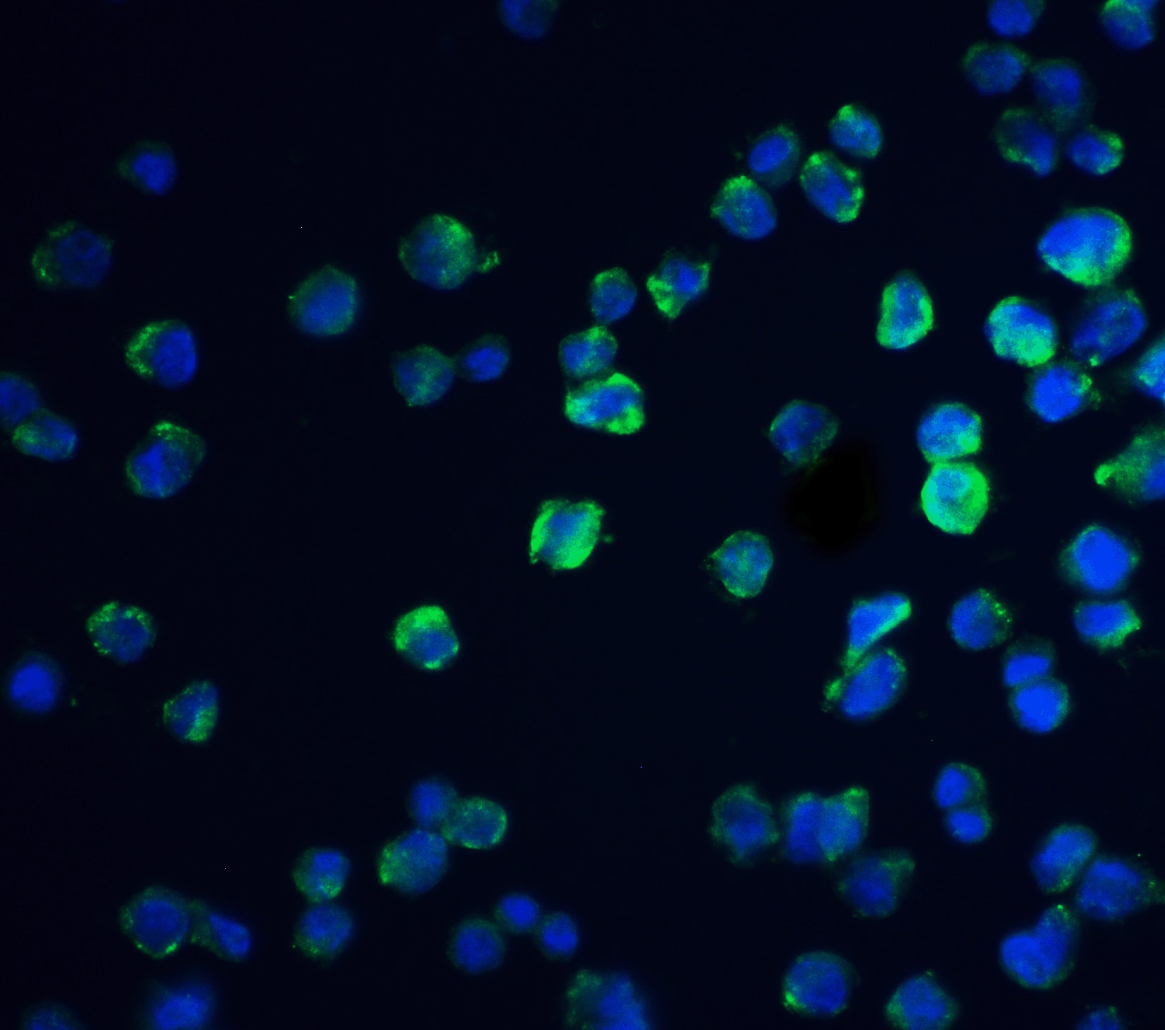 Immunocytochemistry/ Immunofluorescence: REEP3 Antibody - BSA Free [NBP1-77105] - Immunofluorescence of REEP3 in A431 cells with REEP3 antibody at 20 u/mL.Green: REEP3 Antibody   Blue: DAPI staining