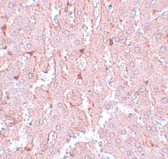 Immunohistochemistry: LXR alpha/NR1H3 Antibody - BSA Free [NBP1-77106] - Immunohistochemistry of LXR alpha/NR1H3 in rat liver tissue with LXR alpha/NR1H3 antibody at 5 u/mL.