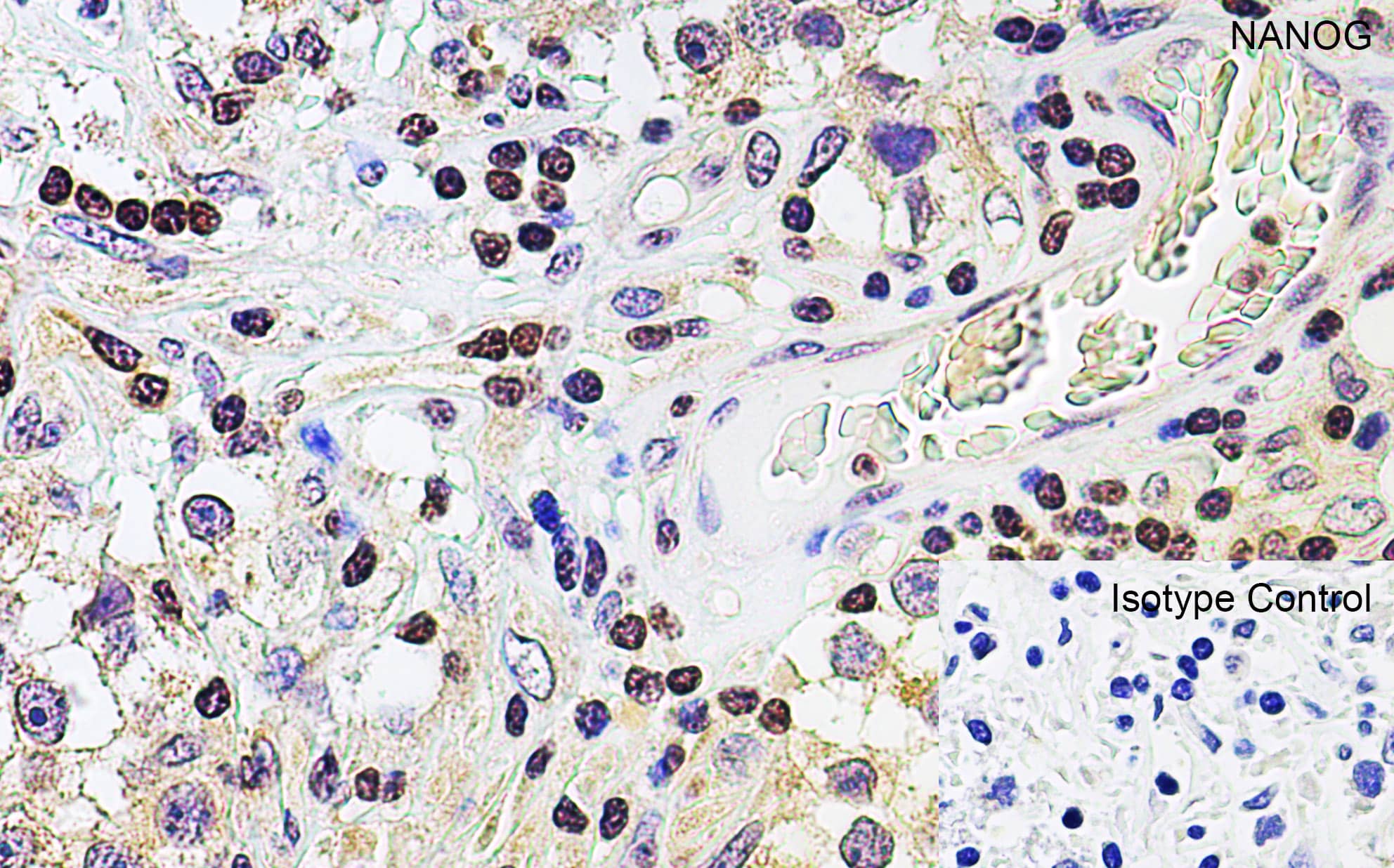 Immunohistochemistry: Nanog Antibody - BSA Free [NBP1-77109] - Validation of Nanog in Human Testis.Immunohistochemical analysis of paraffin-embedded human testis tissue using anti-Nanog antibody at 5 u/ml. Tissue was fixed with formaldehyde and blocked with 10% serum for 1 h at RT; antigen retrieval was by heat mediation with a citrate buffer (pH6). Samples were incubated with primary antibody overnight at 4°C. A goat anti-rabbit IgG H&L (HRP) at 1/250 was used as secondary. Counter stained with Hematoxylin.