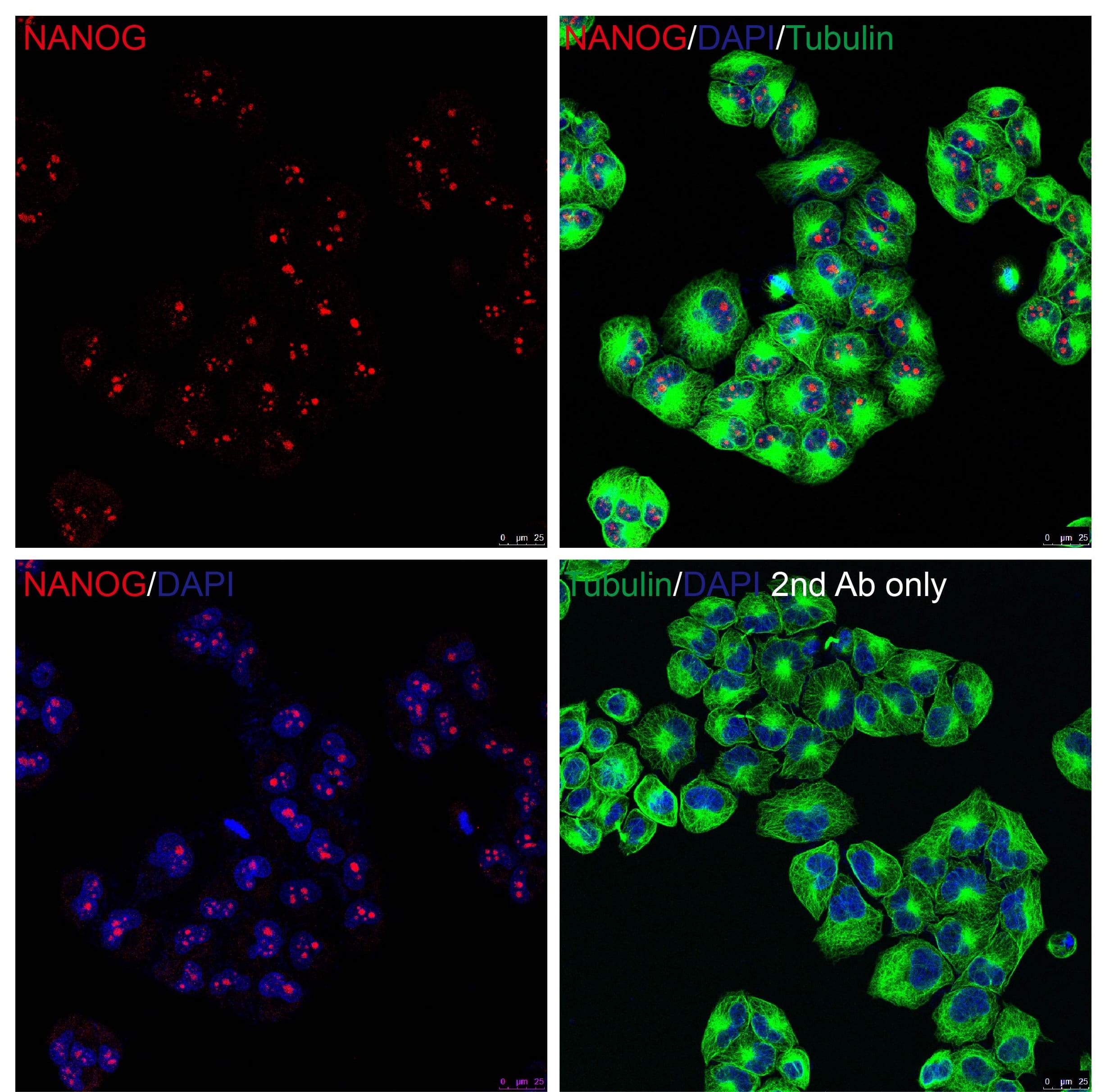 Immunocytochemistry/ Immunofluorescence: Nanog Antibody - BSA Free [NBP1-77109] - Validation of Nanog in HeLa Cells.Immunofluorescent analysis of PFA-fixed HeLa cells labeling Nanog with  at 20 u/mL, followed by goat anti-rabbit IgG secondary antibody at 1/1000 dilution (red) and DAPI staining (blue). Alpha tubulin was stained with anti-alpha tubulin antibody following by goat anti-mouse IgG secondary antibody (green). Images were captured with confocal microscopy.