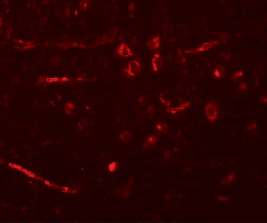 Immunocytochemistry/ Immunofluorescence: CDX2 Antibody - BSA Free [NBP1-77113] - Immunofluorescence of CDX2 in rat brain tissue with CDX2 antibody at 20 u/mL.