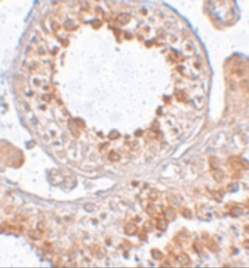 Immunohistochemistry: ESX1 Antibody - BSA Free [NBP1-77114] - Immunohistochemistry of ESX1 in human testis tissue with ESX1 antibody at 2.5 u/mL.