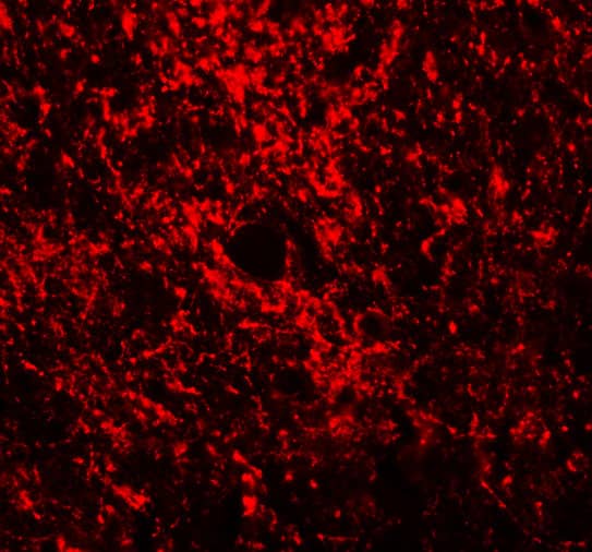 Immunocytochemistry/ Immunofluorescence: GATA-3 Antibody - BSA Free [NBP1-77115] - Immunofluorescence of GATA-3 in Rat Brain tissue with GATA-3 antibody at 20 u/mL.