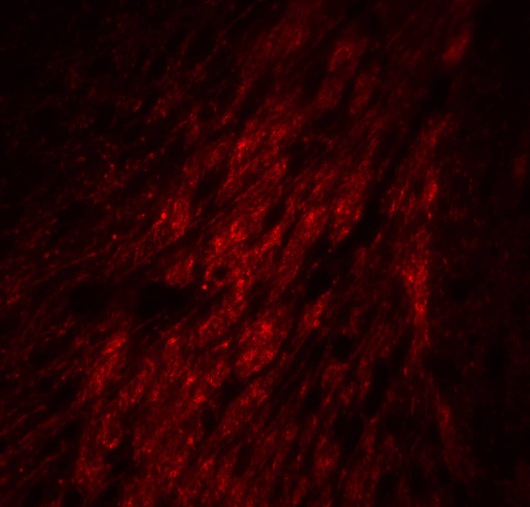 Immunocytochemistry/ Immunofluorescence: GATA-3 Antibody - BSA Free [NBP1-77115] - Immunofluorescence of GATA-3 in mouse brain tissue with GATA-3 Antibody at 20 ug/mL.