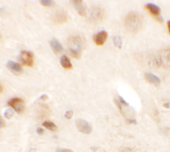 Immunohistochemistry: CMYA5 Antibody - BSA Free [NBP1-77117] - Immunohistochemistry of CMYA5 in mouse brain tissue with CMYA5 antibody at 2.5 u/mL.