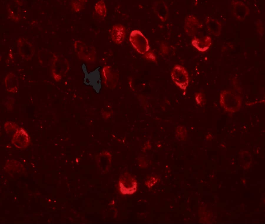 Immunocytochemistry/ Immunofluorescence: CMYA5 Antibody - BSA Free [NBP1-77117] - Immunofluorescence of CMYA5 in mouse brain tissue with CMYA5 antibody at 20 u/mL.