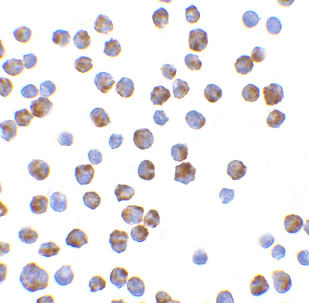 Immunocytochemistry/ Immunofluorescence: Bim Antibody - BSA Free [NBP1-77118] - Figure 5 Immunocytochemistry Validation of BIM K562 Cells Immunohistochemical analysis of K562 cells using anti-BIM antibody  at 10 u/ml. Cells was fixed with formaldehyde and blocked with 10% serum for 1 h at RT; antigen retrieval was by heat mediation with a citrate buffer (pH6). Samples were incubated with primary antibody overnight at 4C. A goat anti-rabbit IgG H&L (HRP) at 1/250 was used as secondary. Counter stained with Hematoxylin.