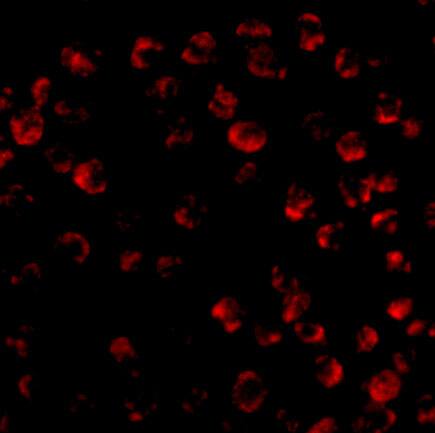 Immunocytochemistry/ Immunofluorescence: Bim Antibody - BSA Free [NBP1-77118] - Figure 4 Immunofluorescence Validation of BIM in K562 CellsImmunofluorescent analysis of 4% paraformaldehyde-fixed K562 cells labeling BIM with  at 20 u/mL, followed by goat anti-rabbit IgG secondary antibody at 1/500 dilution (red). 