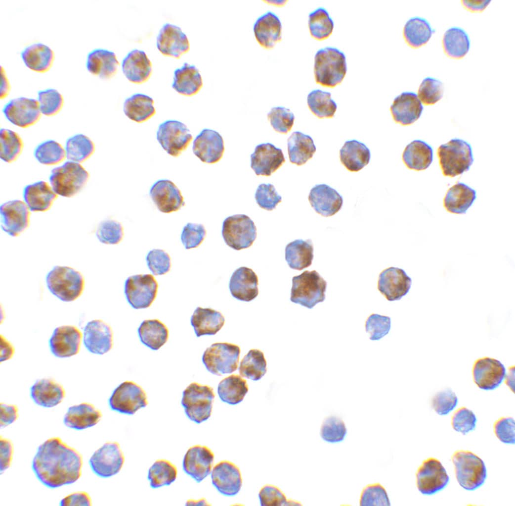 Immunocytochemistry/ Immunofluorescence: Bim Antibody - BSA Free [NBP1-77118] - Figure 5 Immunocytochemistry Validation of BIM K562 Cells Immunohistochemical analysis of K562 cells using anti-BIM antibody  at 10 u/ml. Cells was fixed with formaldehyde and blocked with 10% serum for 1 h at RT; antigen retrieval was by heat mediation with a citrate buffer (pH6). Samples were incubated with primary antibody overnight at 4;C. A goat anti-rabbit IgG H&L (HRP) at 1/250 was used as secondary. Counter stained with Hematoxylin.