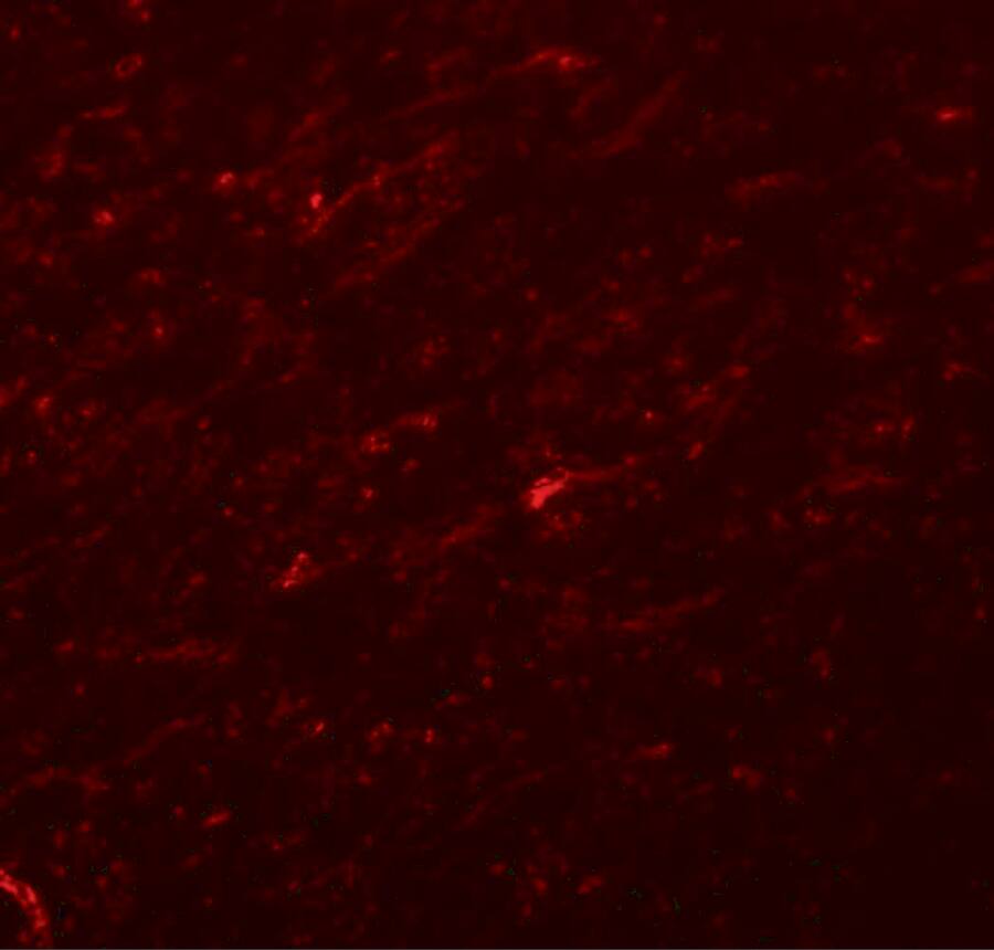 Immunocytochemistry/ Immunofluorescence: TCF-3/E2A Antibody - BSA Free [NBP1-77119] - Immunofluorescence of TCF-3/E2A in rat brain tissue with TCF-3/E2A antibody at 20 u/mL.