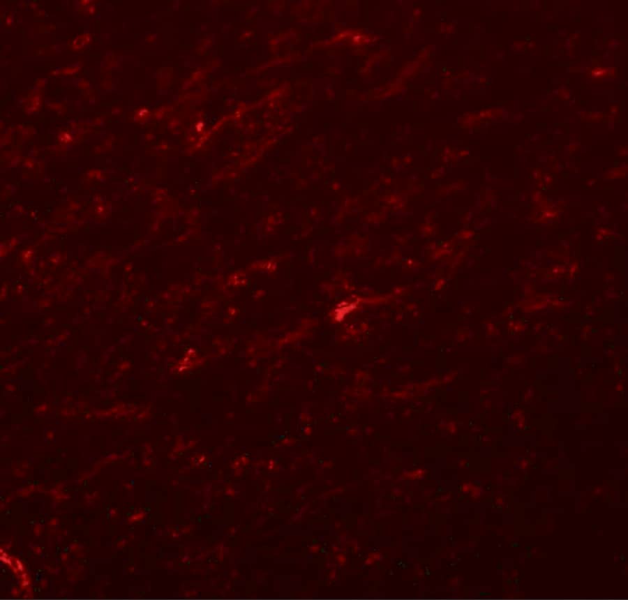 Immunocytochemistry/ Immunofluorescence: TCF-3/E2A Antibody - BSA Free [NBP1-77119] - Immunofluorescence of TCF-3/E2A in rat brain tissue with TCF-3/E2A antibody at 20 u/mL.