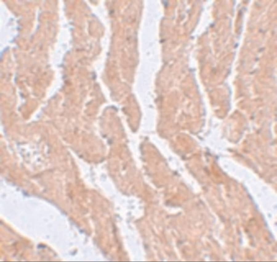 Immunohistochemistry LZTR1 Antibody - BSA Free