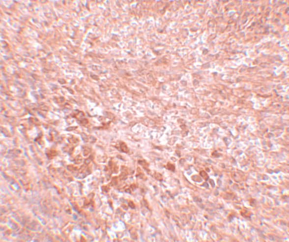 Immunohistochemistry LZTR2 Antibody - BSA Free